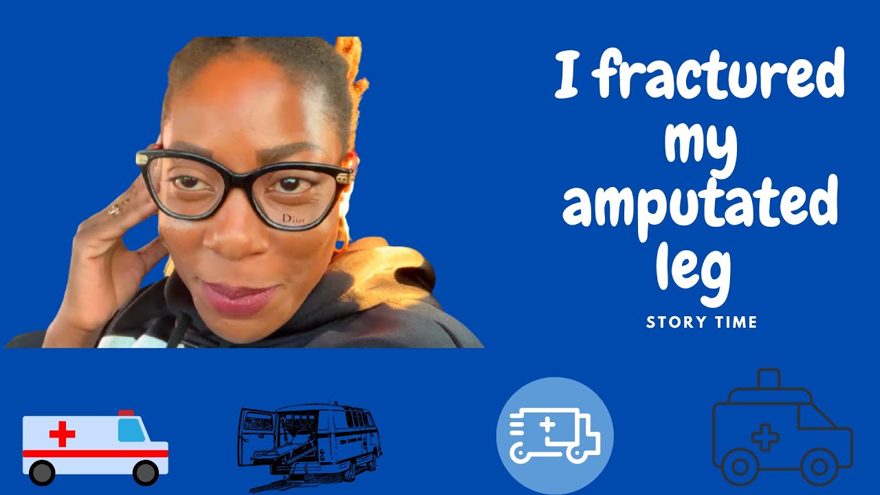 I fractured my amputated leg // Story time