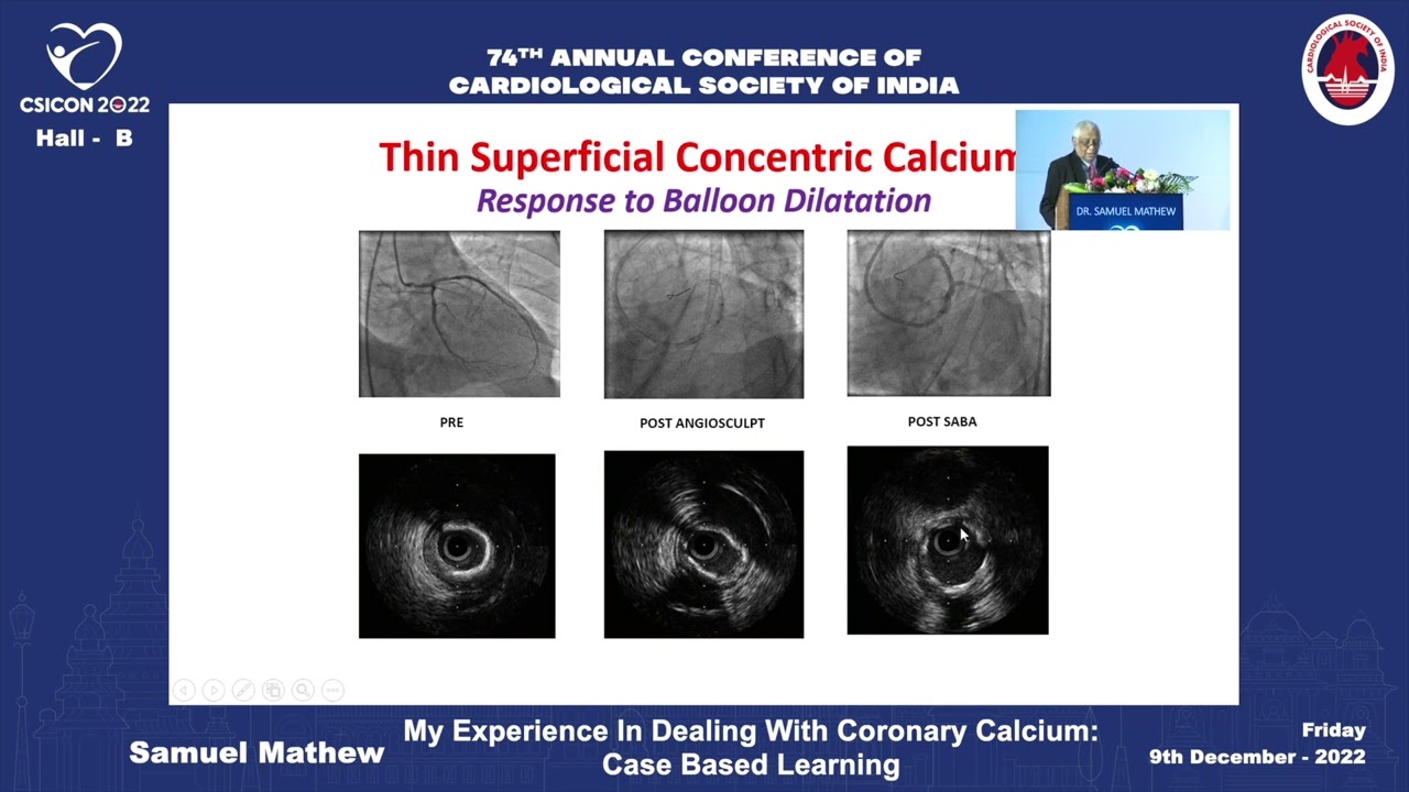 CSI 2022 CSICON REC HALL B DAY 2 Samuel Mathew