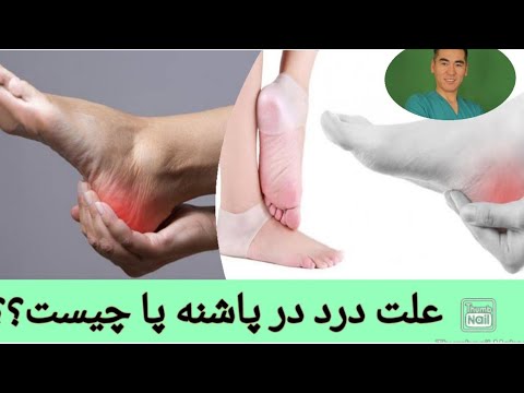 تصویری: 4 راه ساده برای از بین بردن درد پا در حالت ایستاده در تمام طول روز