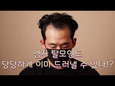 모자만 쓰던 엠자 탈모인에서 정갈한 가르마 스타일로 완벽 변신
