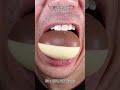 Satisfying Chewing ASMR #Compilation #ASMR #DoctorTristanPeh
