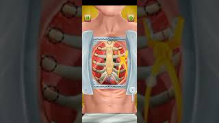 Open Heart Surgery Emergency Hospital Doctor Games | Android iOS Gameplay screenshot 2