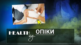 «Health - гід». Опіки