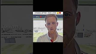 Ben Stokes After Surgery😔🤯 #shorts #cricket #trending