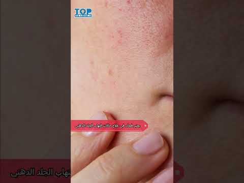 فوائد زيت الزيتون البكر