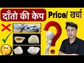 Tooth cap in hindi , what is tooth cap cost, दाँतो के सभी केप की जानकारी
