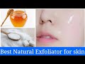 Honey & Sugar Natural Exfoliator Scrub || Clear, Bright & Glowing Skin #homeremedies