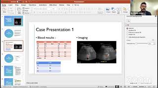 Medical obstructive jaundice - CoPM Weekly webinar 2023 (gastroenterology hepatology)