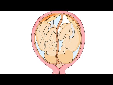 Video: Penyakit Anak Kembar - Toksemia Kehamilan Pada Domba Dan Kambing - Kehamilan Beracun