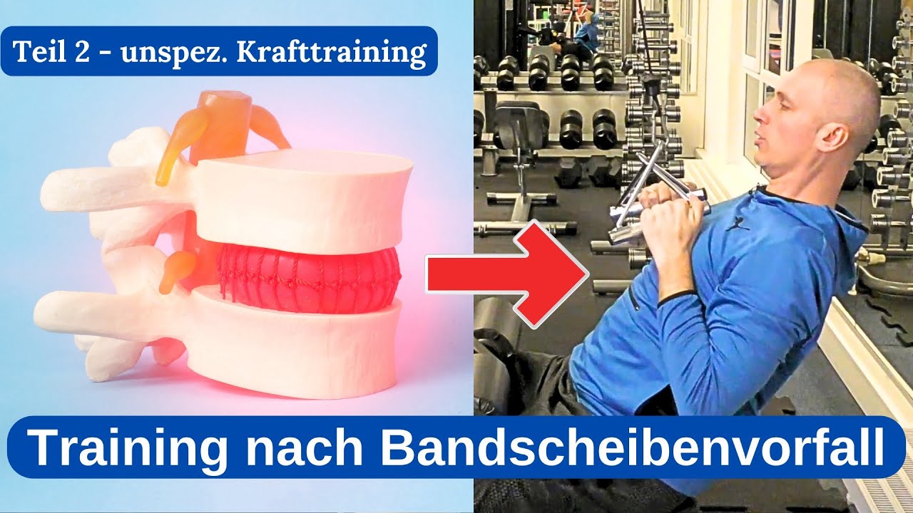 Trainingsplan nach Bandscheibenvorfall Teil 2 (unspez. Krafttraining) YouTube