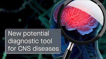 Novel detection system for prognosis of CNS diseases: unveiling the EV Neuro assay