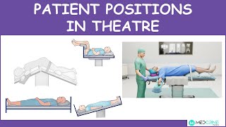 Patient positions and positioning in an operating theater