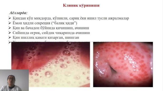 Banyoda yuzsiz mushuklarning fotosuratlari Haram porno filmidagi amaldorlar