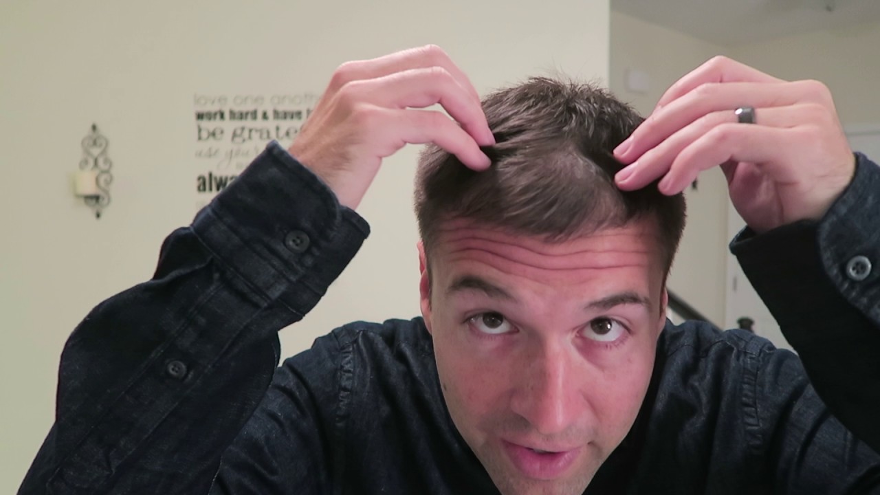 Balding Norwood 3, No Pomade: Verge of Collapse - YouTube