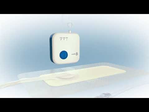 Avelle Negative Pressure Wound Therapy System application and removal - a knee surgery