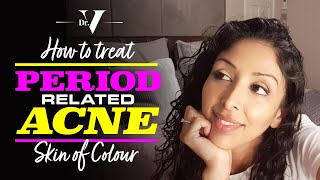 Dr V - How To Treat Period Related Acne for Skin of Colour | Brown/ Black skin | Skin of colour |