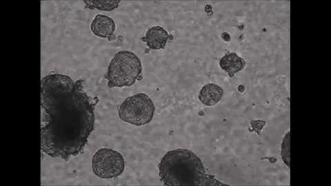 A molecular portrait of epithelial–mesenchymal plasticity in prostate cancer associated