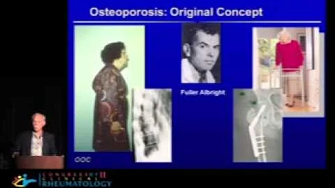 State of the Art of Treatment of Osteoporosis - Mi...