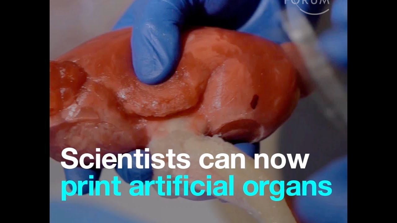 artificial organs