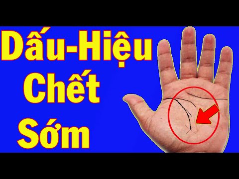 Video Những Dấu Hiệu Bí Ẩn Đằng Sau Đường Chỉ Tay Của Người... - youtube