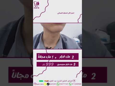 حتى نفاذ الكمية 2 مل فيلر سويسري 1 مل فيلر مجانا