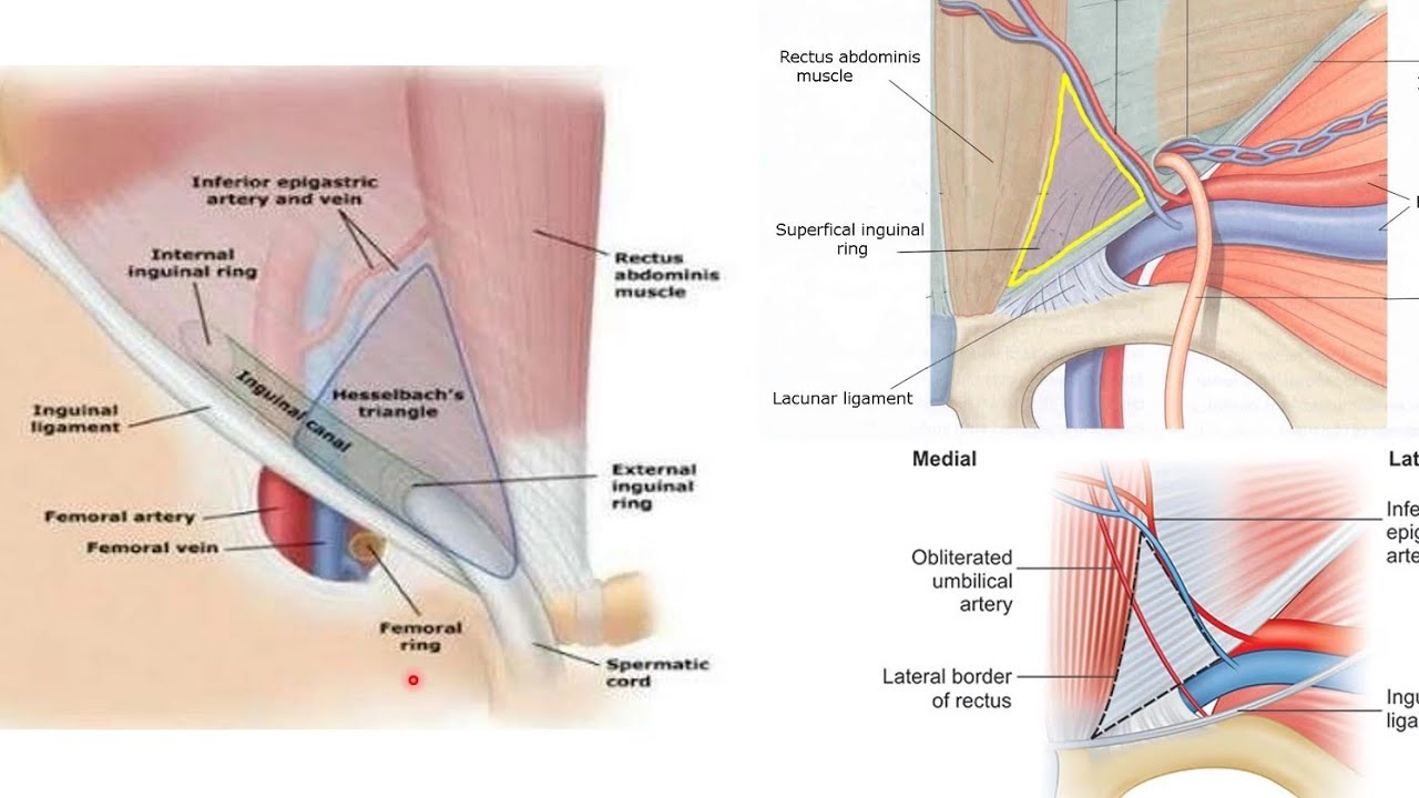 Inguinal Canal – Surgical Notes