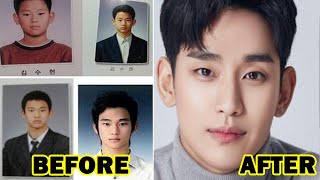 Kim Soo hyun before and after