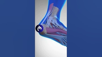 See what Plantar Fasciitis of the Foot looks like in #3D #animation #feet