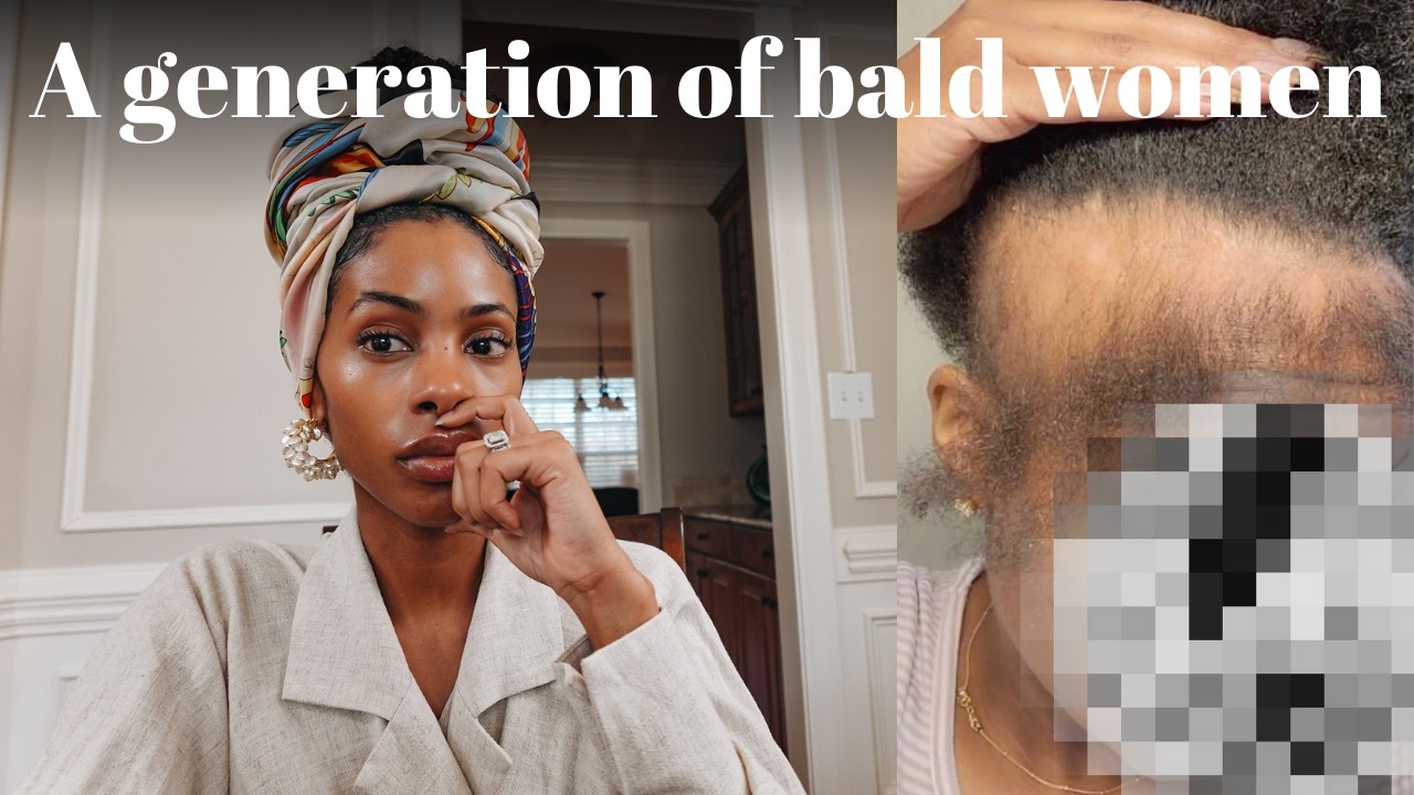 We Are Raising A Generation of Bald Women - Weaves, Wigs, Self Love