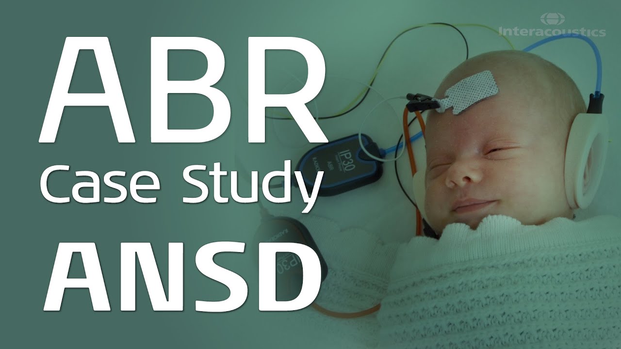 ABR Case Study: ANSD - YouTube