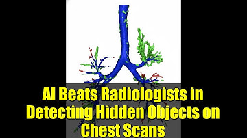 AI Beats Radiologists in Detecting Hidden Objects on Chest Scans