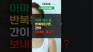 이마에 뾰루지 반복된다면, 이 장기 문제일 수 있습니다 #이마여드름 #간기능저하 #스트레스피부 #피부건강 #트러블원인 #생활건강 #건강정보