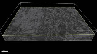 Famous ZeroCostDL4Mic Video #3: Using 3D U-Net for the segmentation of mitochondria from EM data Wealth