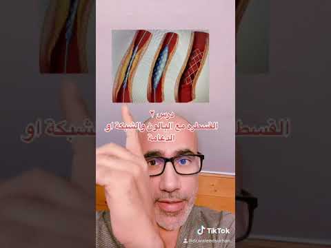 كيف تجرى القسطرة للشريان التاجي مع بالون وشبكة بدقيقة وليد سرحان قسطرة
