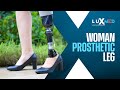 Woman prosthetic leg  ssur proflex lp align  luxmed