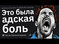 Худшая Физическая БОЛЬ в Вашей Жизни #2