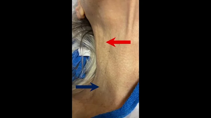 Arterial vs Venous Pulse in the Neck | Simple Bedside Technique