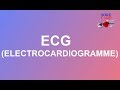 Lectrocardiogramme