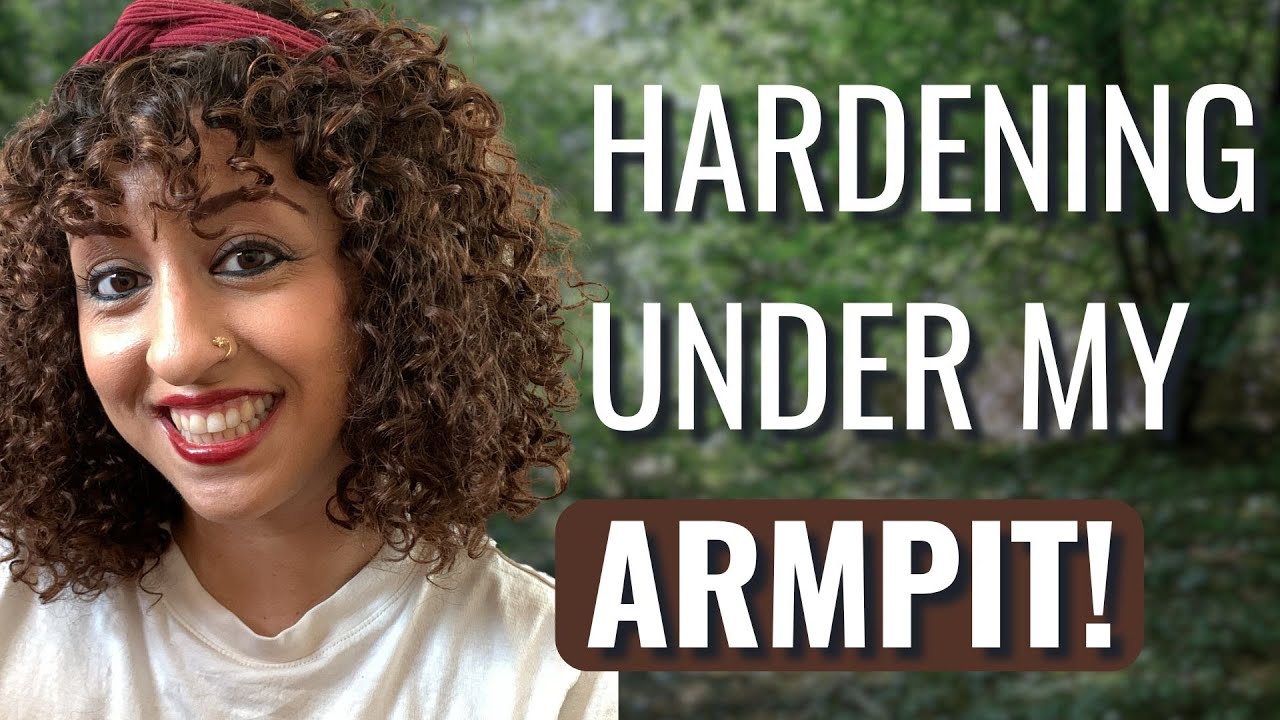 How I Found Out I Had STAGE 4 CANCER at 34! - Nina | Stage 4 Breast ...