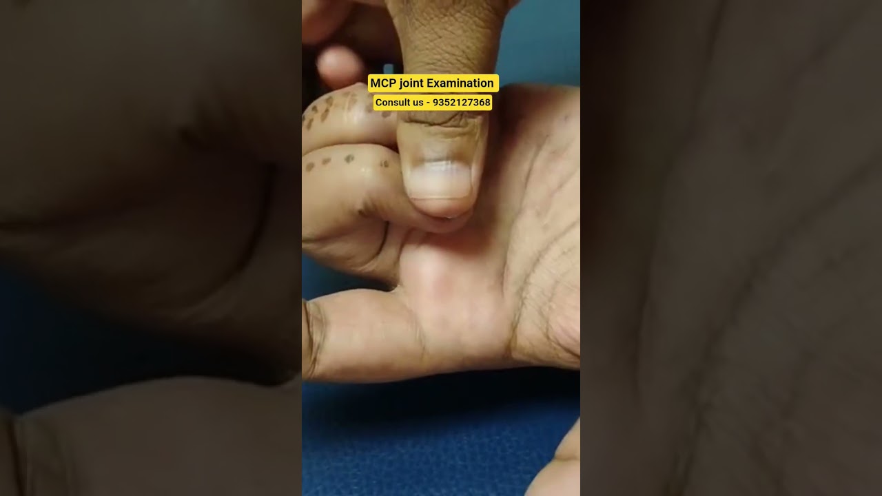 MCP joint Examination 