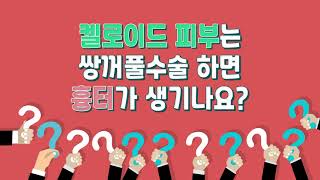 앞트임, 쌍꺼풀 흉터, 켈로이드 발생하나요?