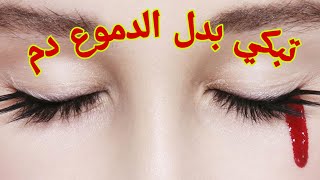 تبكي بدل الدموع دم . ايه السبب | عجائب وغرائب | اجيال الاندلس