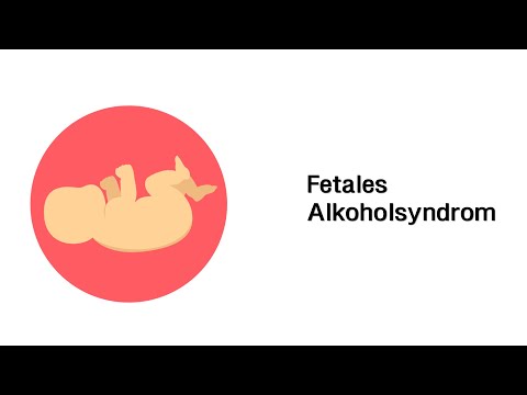 Video: Fetales Alkoholsyndrom: Ursachen, Symptome Und Diagnose