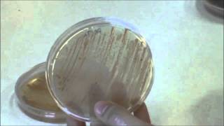 Técnicas básicas de Microbiología: Aspecto de bacterias del género Micromonospora.