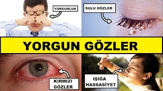 Yorgun Ve Zorlanan Gözlerin Arkasındaki Vitamin Eksikliği Drberg Türkçe
