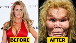 20 Celebrity Plastic Surgery Disasters