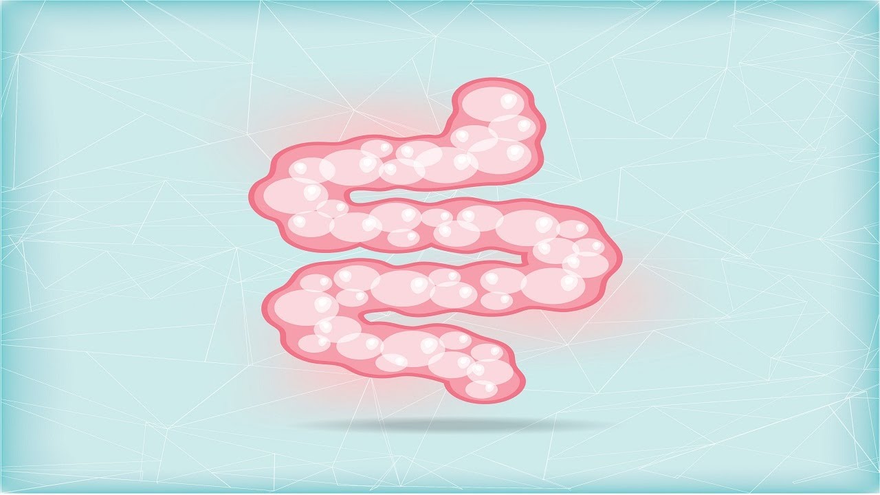 Rifaximin (Xifaxan): Why It May or May Not Improve Your SIBO and How to Make It Work for You
