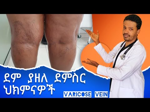 ቪዲዮ: ለደም ነጠብጣብ ምርመራ ጣት እንዴት እንደሚመታ (ከስዕሎች ጋር)