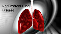 Rheumatoid Lung Disease