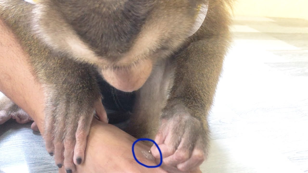 Smart Jason Proper Grooming Pull Out Dead Scar Cell On Leg To Fast Healing